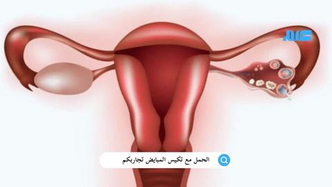 الحمل مع تكيس المبايض تجاربكم: العلاج للنساء